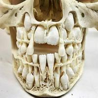 🔥 If Teeth has a personality type...